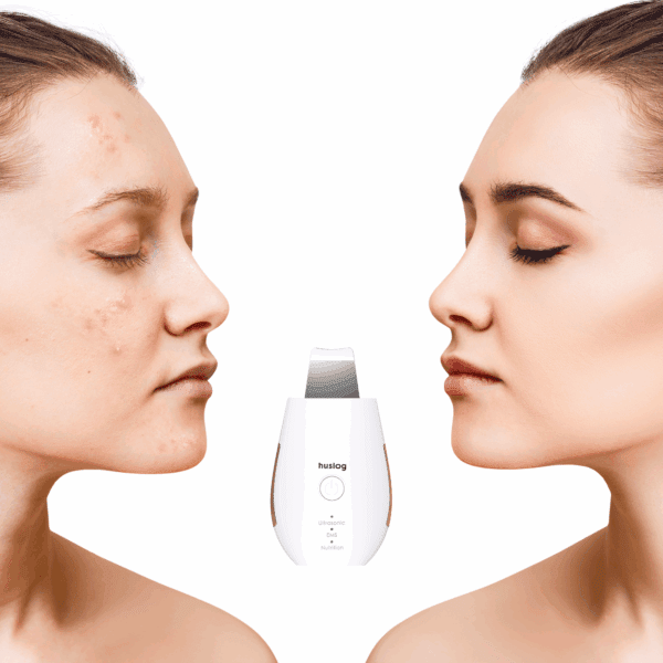 371200_oryg Huslog skin purifier BE-100224